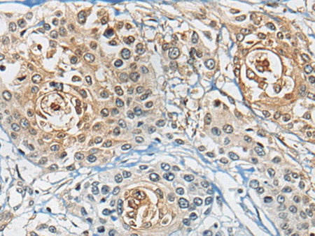 CD8A Polyclonal Antibody