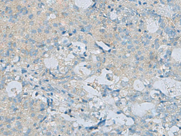 CDH12 Polyclonal Antibody