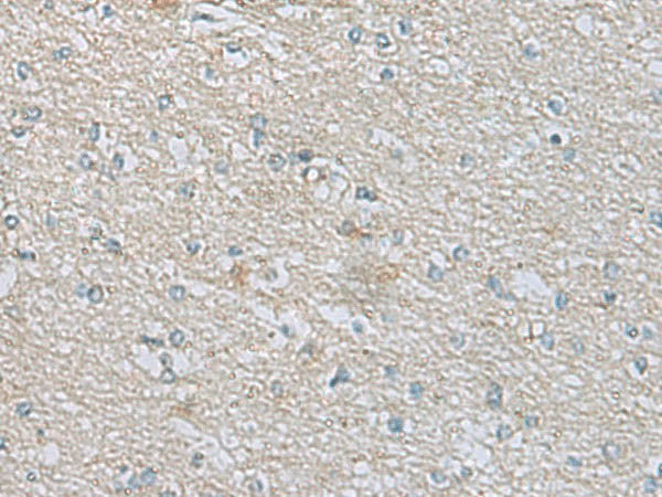 CDH12 Polyclonal Antibody