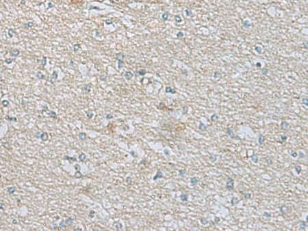 CDH12 Polyclonal Antibody