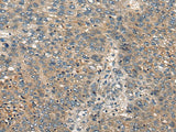 CDKL2 Polyclonal Antibody