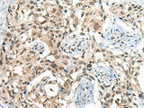 CDKL2 Polyclonal Antibody