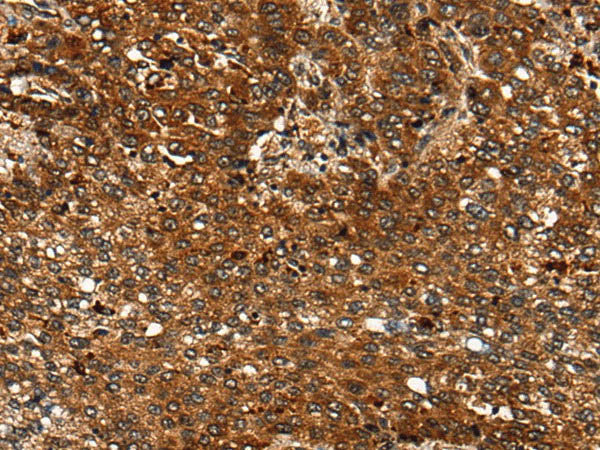 CDKL4 Polyclonal Antibody