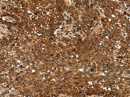 CDKL4 Polyclonal Antibody