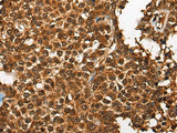 CDKL4 Polyclonal Antibody