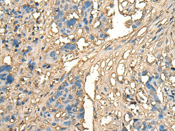CELA1 Polyclonal Antibody