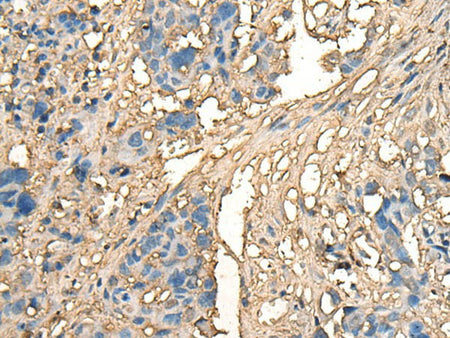 CELA1 Polyclonal Antibody