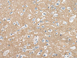 CADM2 Polyclonal Antibody
