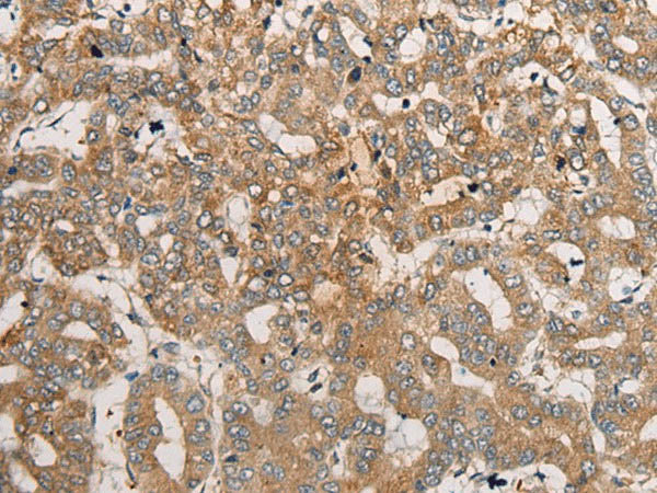 CEND1 Polyclonal Antibody