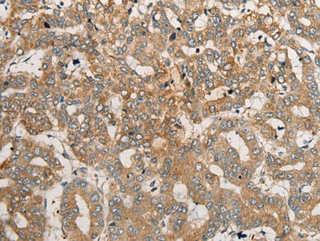 CEND1 Polyclonal Antibody
