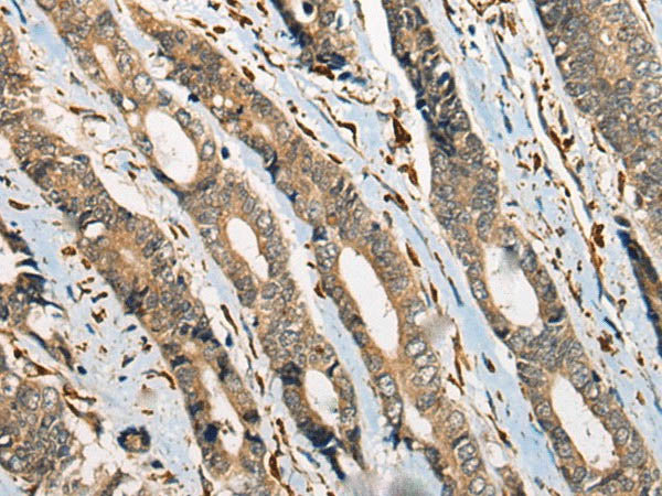 ODF2 Polyclonal Antibody
