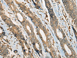 ODF2 Polyclonal Antibody