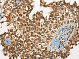 ODF2 Polyclonal Antibody