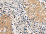 AGAP3 Polyclonal Antibody