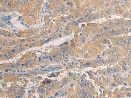 AGAP3 Polyclonal Antibody