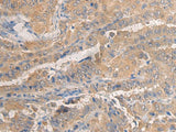 AGAP3 Polyclonal Antibody