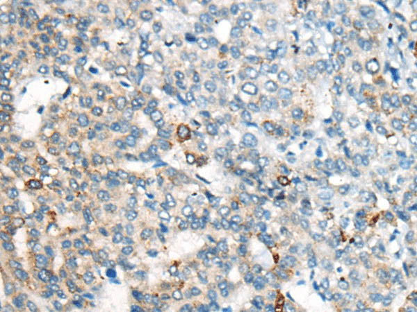 CES2 Polyclonal Antibody