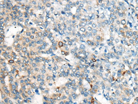 CES2 Polyclonal Antibody