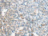 CES2 Polyclonal Antibody