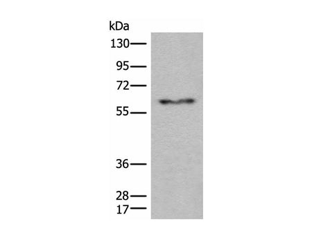 CES2 Polyclonal Antibody