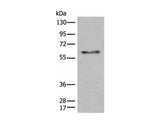 CES2 Polyclonal Antibody