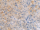 CHST3 Polyclonal Antibody