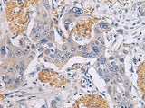 CHST3 Polyclonal Antibody