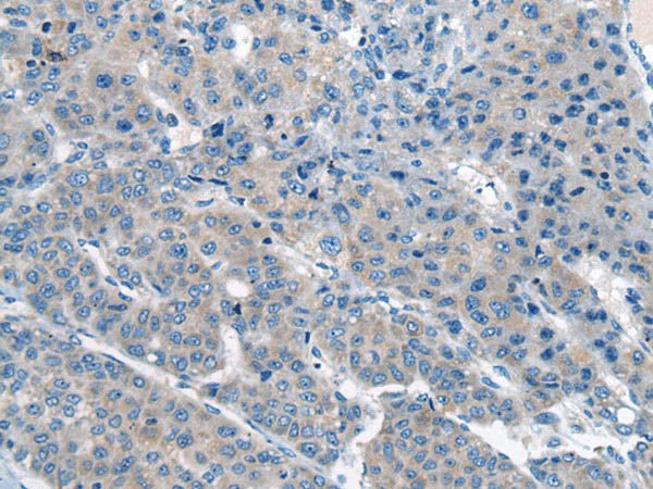 CITED4 Polyclonal Antibody