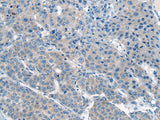 CITED4 Polyclonal Antibody