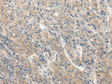 CLIC6 Polyclonal Antibody
