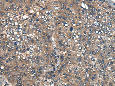 ICMT Polyclonal Antibody