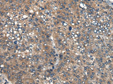 ICMT Polyclonal Antibody