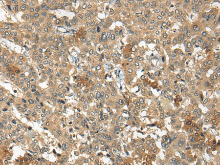 ARCN1 Polyclonal Antibody