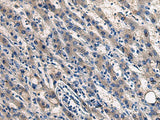 COL17A1 Polyclonal Antibody