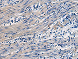 COL17A1 Polyclonal Antibody