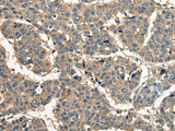 CORO1B Polyclonal Antibody
