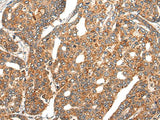 EPHA6 Polyclonal Antibody