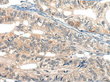 EPHA6 Polyclonal Antibody