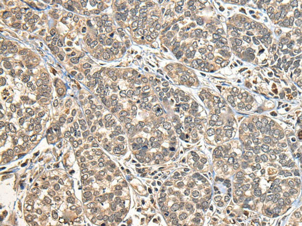 DGKI Polyclonal Antibody