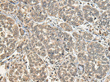 DGKI Polyclonal Antibody
