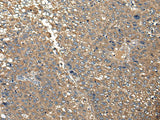 DGKI Polyclonal Antibody