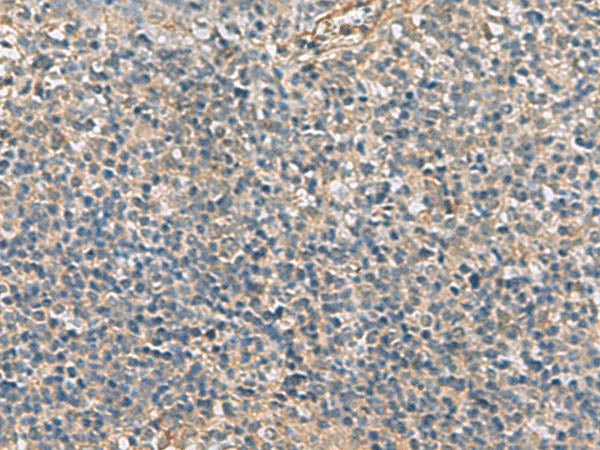 APOBR Polyclonal Antibody