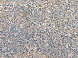 APOBR Polyclonal Antibody