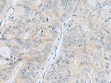 APOBR Polyclonal Antibody