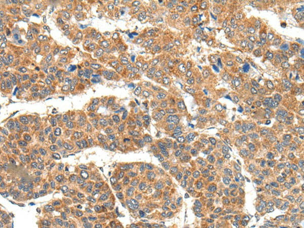 RPL14 Polyclonal Antibody