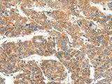 RPL14 Polyclonal Antibody