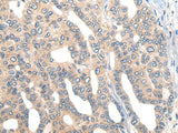 CORO2B Polyclonal Antibody