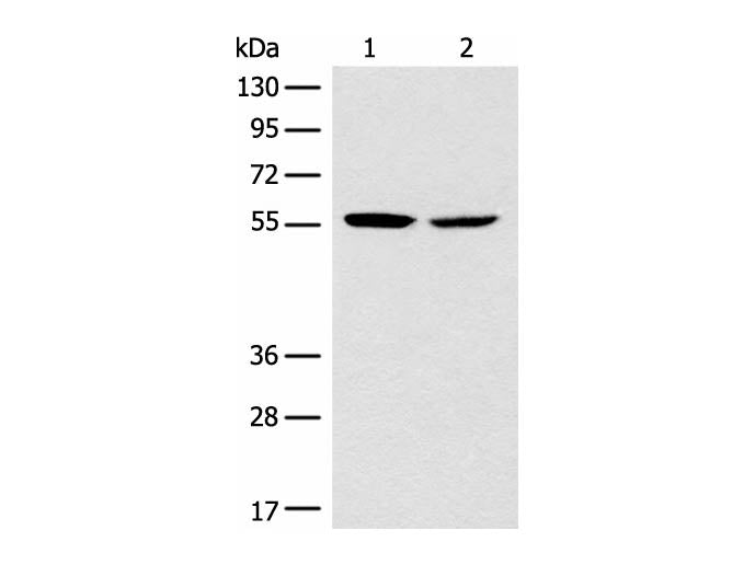 CORO2B Polyclonal Antibody