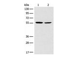 CORO2B Polyclonal Antibody