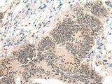 AURKA Polyclonal Antibody